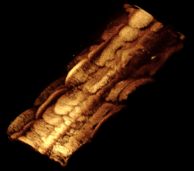 醫(yī)用介入器械聯(lián)合實驗室 醫(yī)用介入器械聯(lián)合實驗室